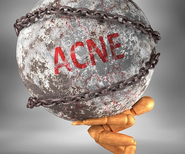 Pourquoi on a de l acne a l adolescence